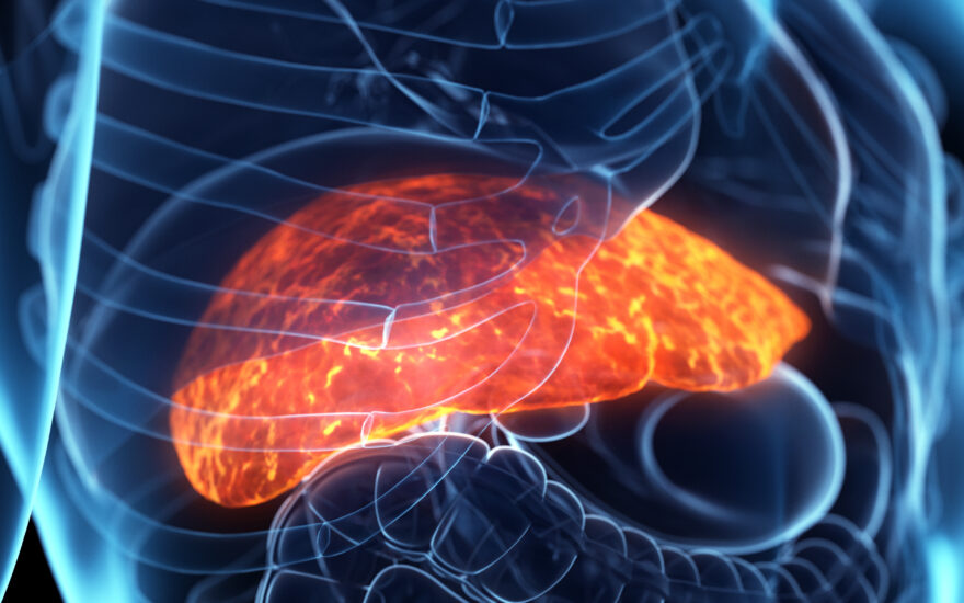 Getting GRIP on NASH: Implementation of an international screening program