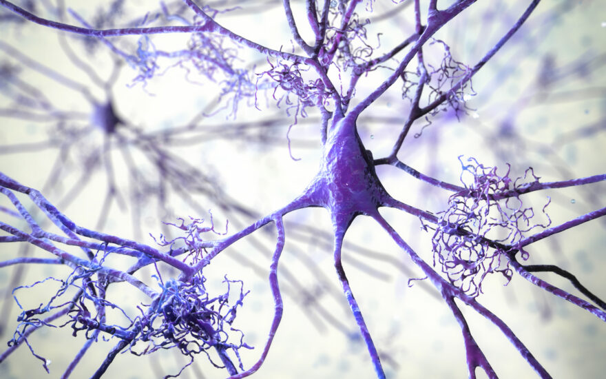 Innovative Endpoints in Alzheimer’s Disease Clinical Trials