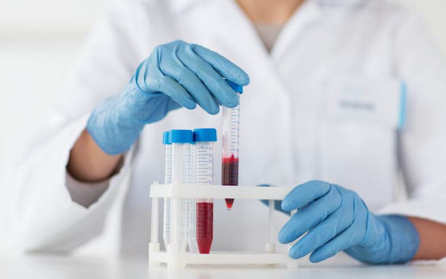 Cutting-edge developments in blood-based biomarkers for Alzheimer’s; application in clinical trials