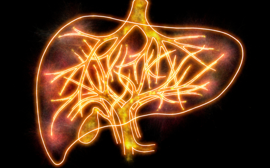 Webinar: Why NASH trials frequently fail and how to improve them