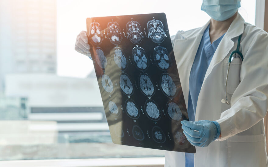 Webinar: Plasma biomarkers for diagnosis and monitoring of neurodegenerative disorders