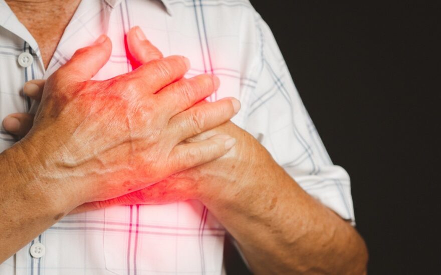 Cardiovascular risk in elderly with obesity and liver fibrosis: Benefits of statins